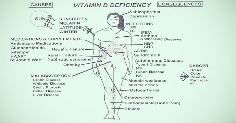 9 signs of Vitamin D deficiency