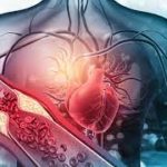 Nitric Oxide---A Well Kept Secret for Cardiovascular Health